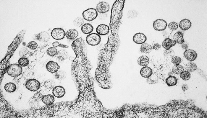 Foto: Photo: CDC/Cynthia Goldsmith