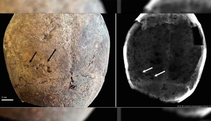 Sinais-de-uso-de-cocaina-em-mumias-1536x864-1-1024x576-1