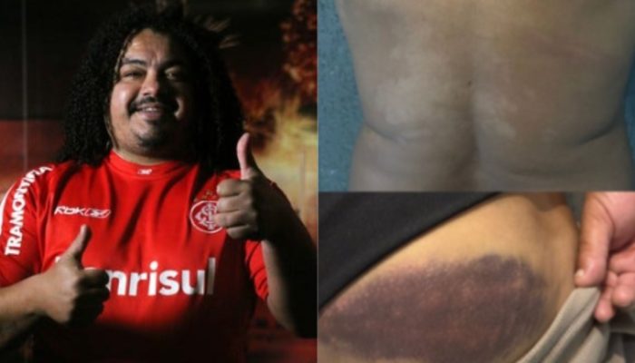Perdigão, ex-Corinthians e Inter, foi agredido por um policial militar — Foto: R